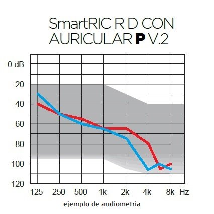 Aparatos Auditivos WIDEX SmartRIC 330 Recargables 2pzas - Imagen 4